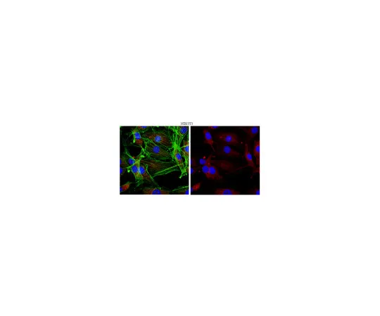 62-8374-99　反猛禽，克隆1H6.2;100μg　05-1470