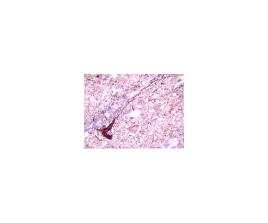 62-8453-35　反头磷胺231;100μL　AB9668