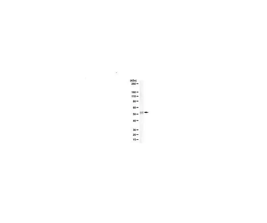 62-8464-66　抗FcRn (FCGRT)　ABF191