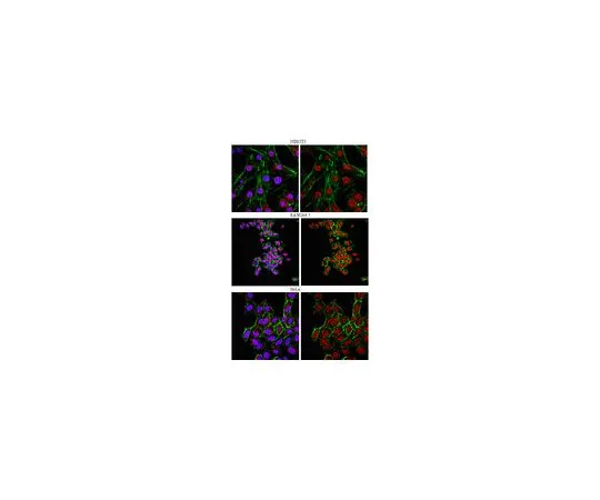62-8446-69　抗FOXP1;100μg　AB2277