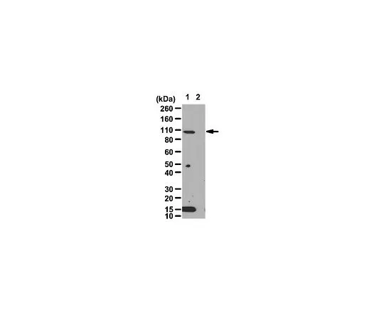 62-8460-94　抗HIF-1α　ABE279