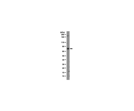 62-8369-33　抗MDM2,克隆3G9;100μg　04-1530