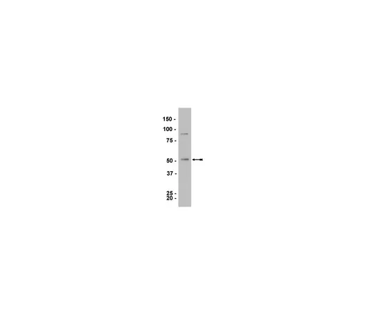 62-8373-33　抗LKB1,克隆5c10;100μg　05-832
