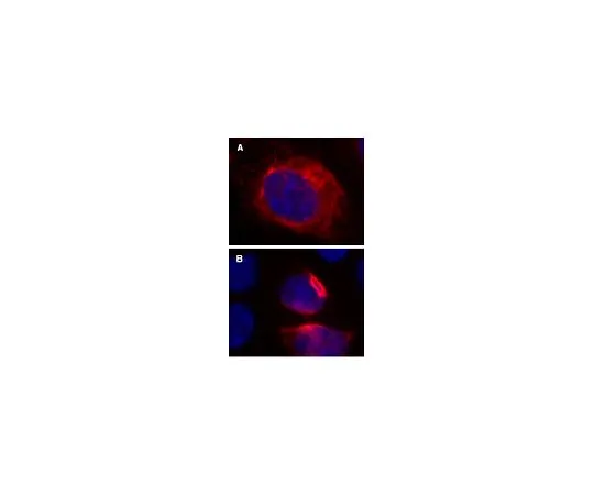 62-8394-36　慢Brite (TM) RFP-Vimentin慢病毒生物传感器　17-10153