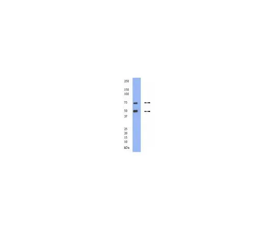 62-8446-46　抗多巴胺转运蛋白;100μg　AB2231