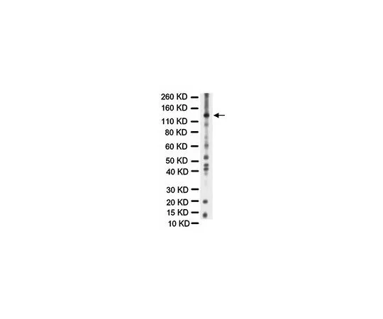 62-8449-88　抗一氧化氮合酶II;50μL　AB5382