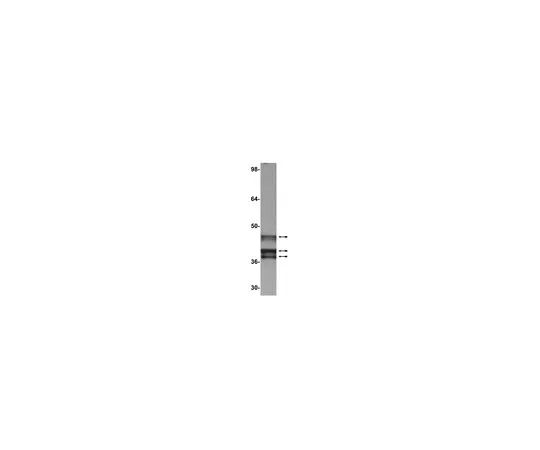 62-8371-93　抗E1A (Ad2/Ad5) ，克隆M73;100μg　05-599