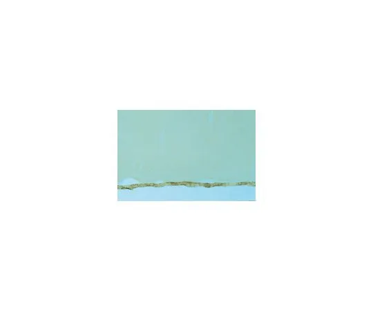 62-8445-40　抗GABA转运蛋白2;10μg　AB1572