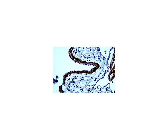 62-8465-58　抗拜斯亭;100μg　ABN68