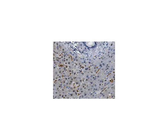 62-8458-24　抗二氢嘧啶脱氢酶/DPYD　ABC451