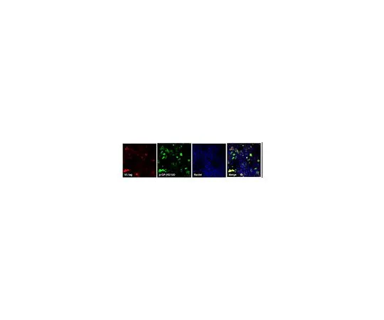 62-8468-17　抗C9ORF72/C9RANT (PolyGP sense/antisense)　ABN1358