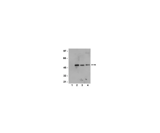 62-8372-73　抗磷MEK1 (Ser218/222) /MEK2 (Ser222/226);100μL　05-747
