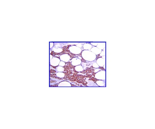 62-8387-80　抗IκB;100μL　07-1483