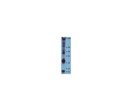 62-8392-85　抗磷酪氨酸，克隆PY20, HRP共轭;10个污点　16-454
