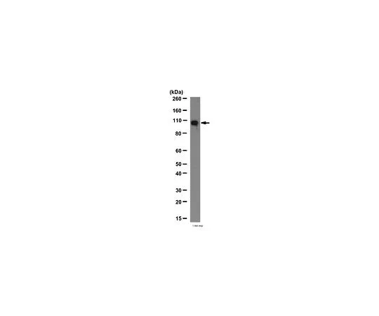 62-8387-45　抗ECT2;100μg　07-1364