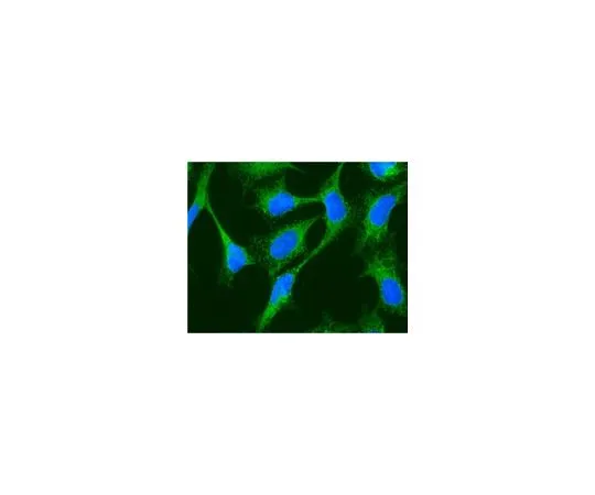 62-8387-62　抗葡萄糖调节蛋白94 (GRP94);100μL　07-1408