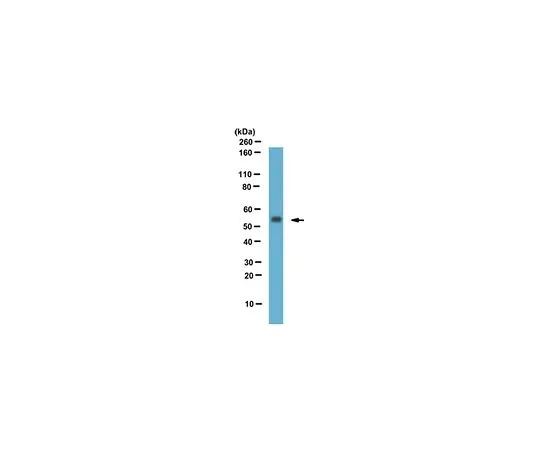 62-8465-85　抗RGS11 (C末端);100μg　ABN111
