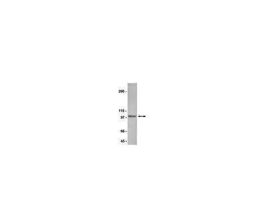 62-8384-53　反NR3B;200μg　07-351