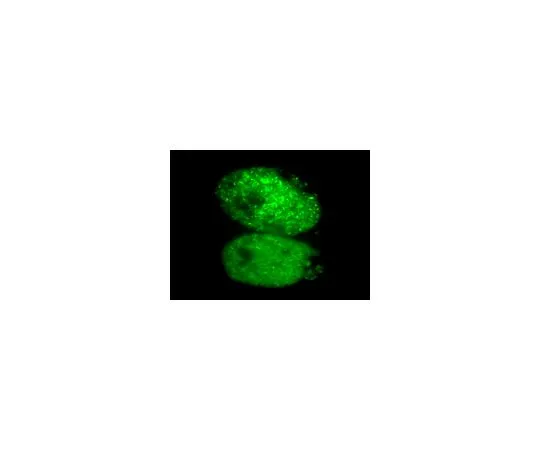 62-8394-68　慢Brite (TM) GFP-Rad51慢病毒生物传感器　17-10234