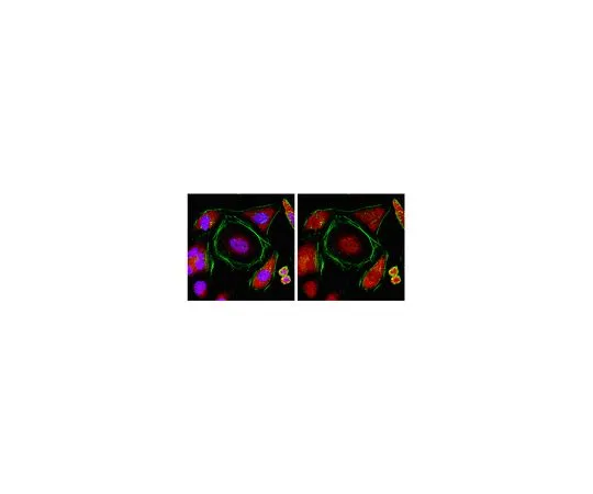62-8453-88　抗TNRC6B;100μg　AB9913