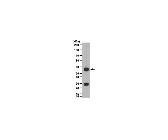 62-8383-65　抗钙调神经磷酸酶A/PP2B催化装置　07-068-I