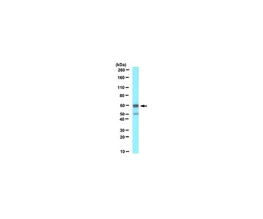 62-8456-96　抗Pex14 (过氧化物酶体膜标记物)　ABC142