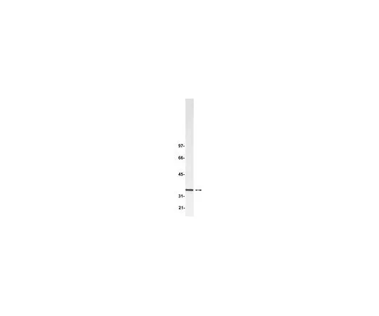 62-8383-89　Anti-Blys/TALL-1/BAFF/THK;100μg　07-167