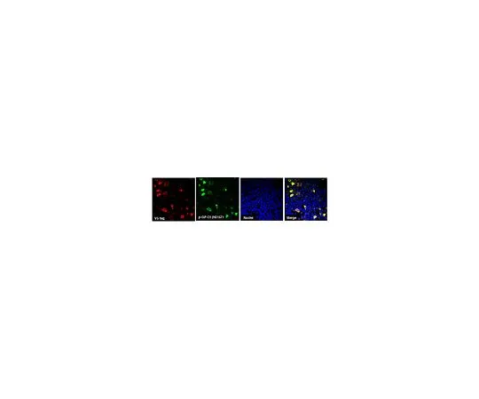 62-8468-16　抗C9ORF72/C9RANT (GPsense-CT)　ABN1357