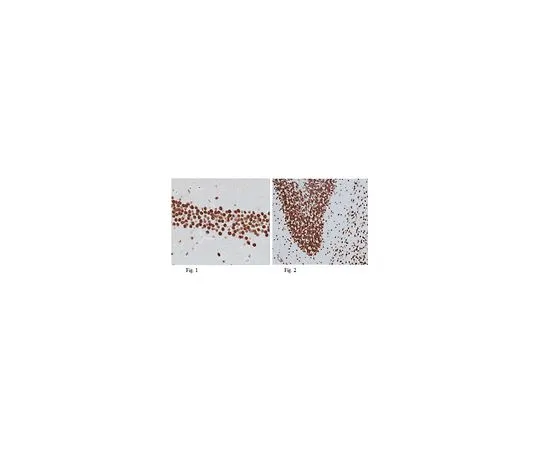 62-8465-81　抗索11　ABN105