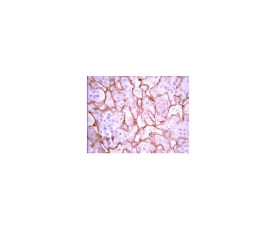 62-8387-66　抗VEGF;50μg　07-1420