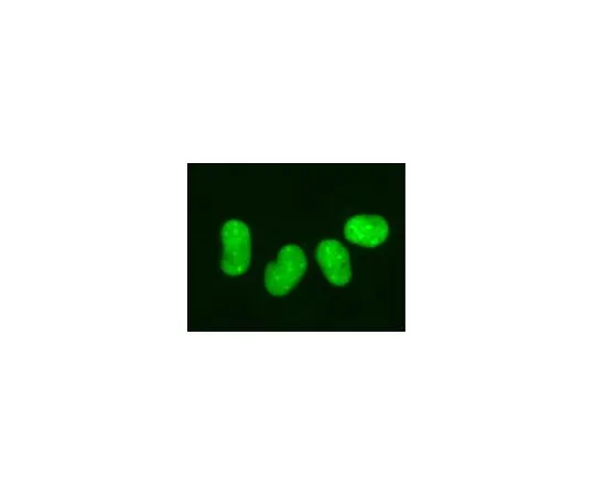 62-8394-33　慢Brite (TM) GFP-HMGB1慢病毒生物传感器　17-10147