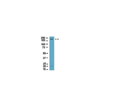 62-8389-74　反Dock2;100μg　09-454