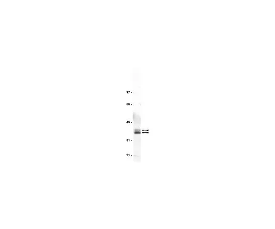 62-8382-10　反LAT;400μg　06-807