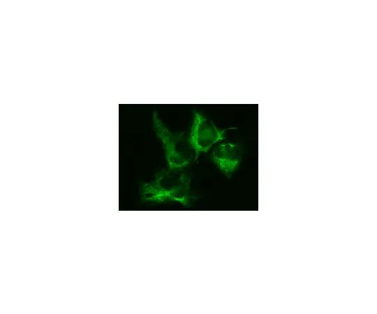 62-8394-35　慢Brite (TM) GFP-Vimentin慢病毒生物传感器　17-10152
