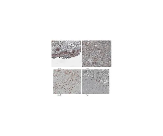 62-8465-43　抗FGF10;100μg　ABN44