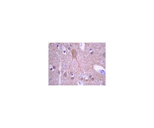62-8445-35　抗物质P,疼痛;100μL　AB1566