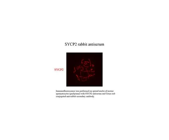62-8464-36　反SYCP2　ABE2622