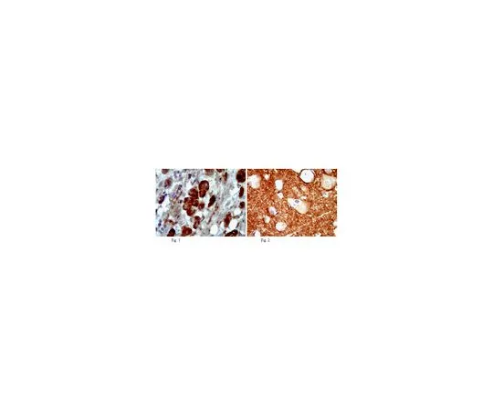 62-8465-56　抗胆固醇酰基转移酶1;100μg　ABN66