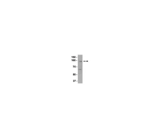 62-8386-25　抗EZH2;200μL　07-689