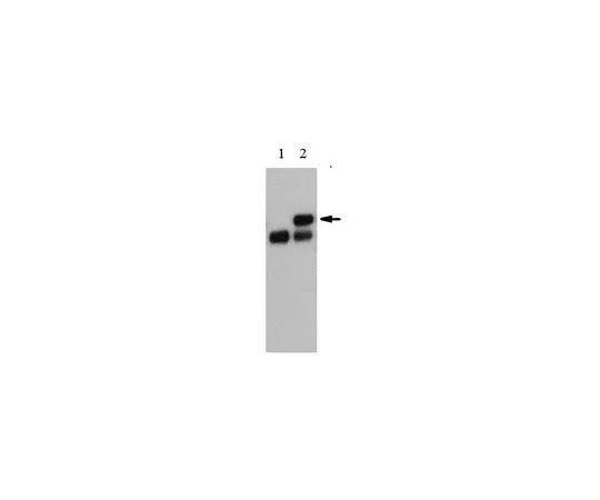 62-8465-14　反TOE1 (Ab-86)　ABF1069