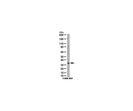 62-8454-61　抗Galtin-3;100μL　AB10541