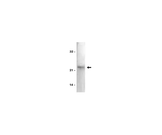 62-8370-78　反p21/WAF1/Cip1;200μg　05-345