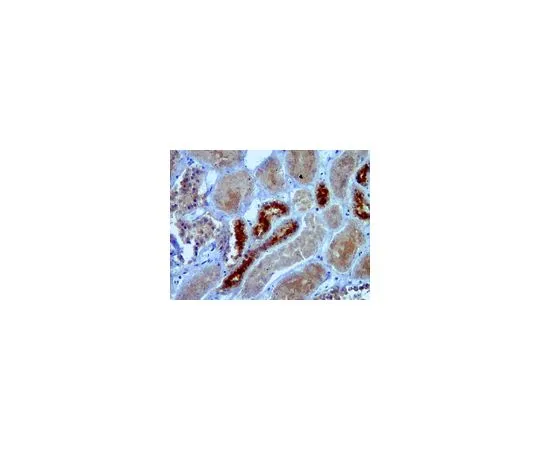 62-8460-36　反SIRT7;100μg　ABE103