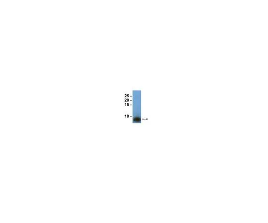 62-8385-92　抗表面活性蛋白B;50μL　07-614