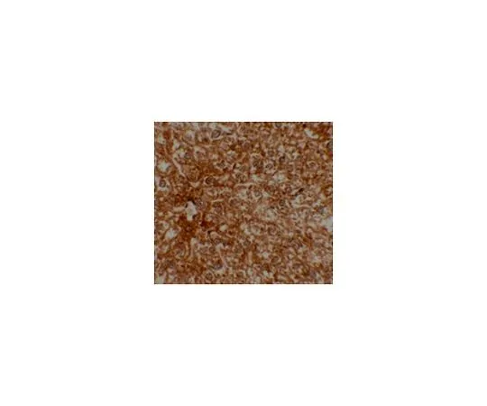 62-8467-60　抗EPAC2　ABN492