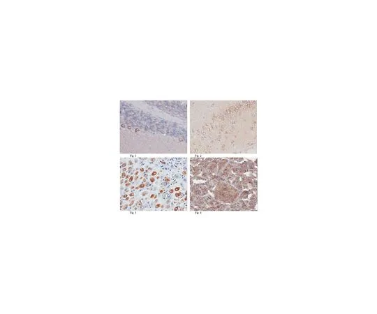 62-8466-01　抗TFG;100μg　ABN180