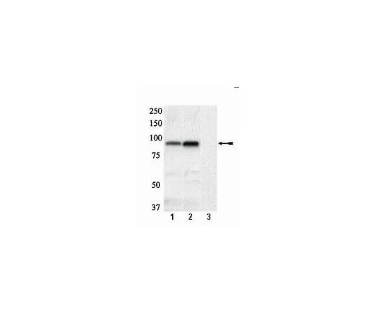 62-8386-69　抗磷-糖原合成酶 (Ser641/Ser645);100μL　07-817