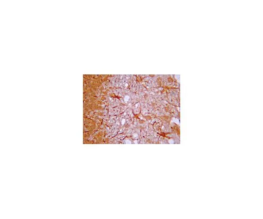 62-8387-17　抗IP3受体;100μg　07-1210