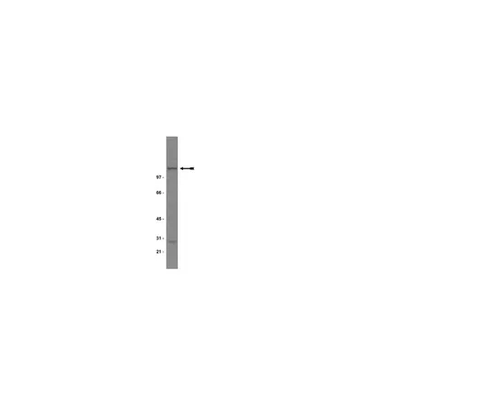 62-8371-14　抗NR1, CT;200μg　05-432
