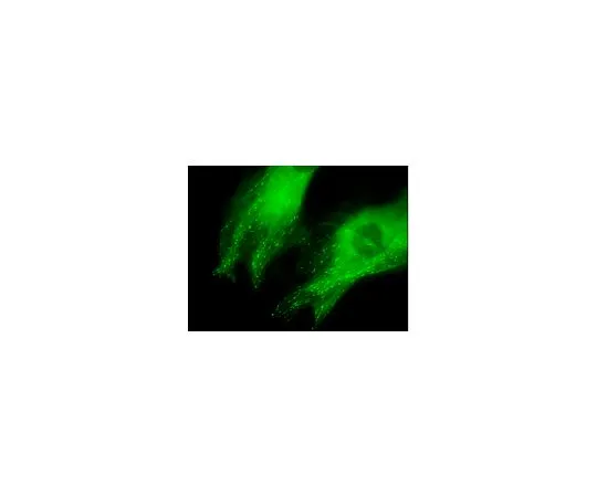 62-8394-53　慢Brite (TM) EB3-GFP慢病毒生物传感器　17-10208